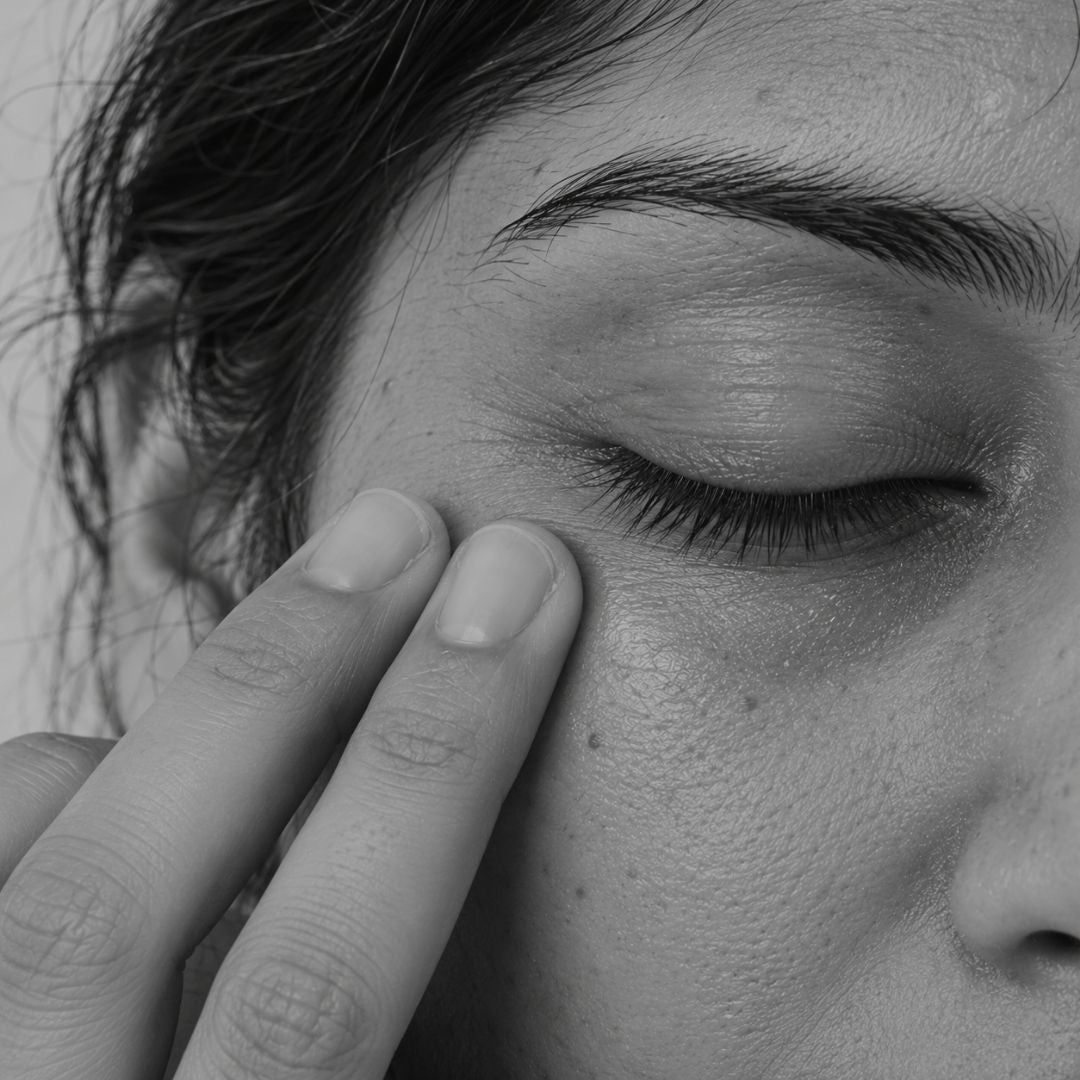 Dark circles — Ayurvedic under-eye care from Ayurveda Amrita
